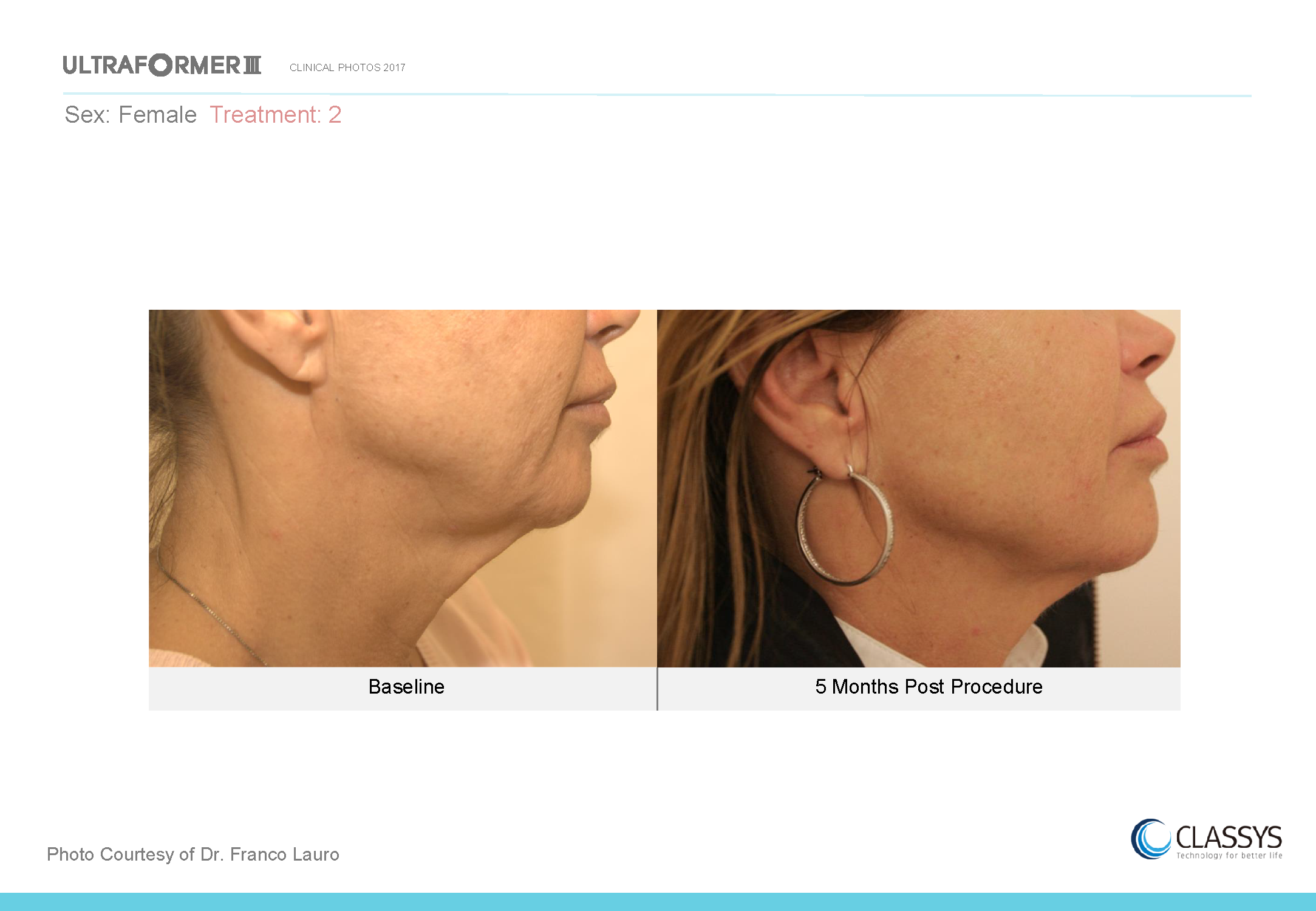 UF3 Face Clinical Photos 11